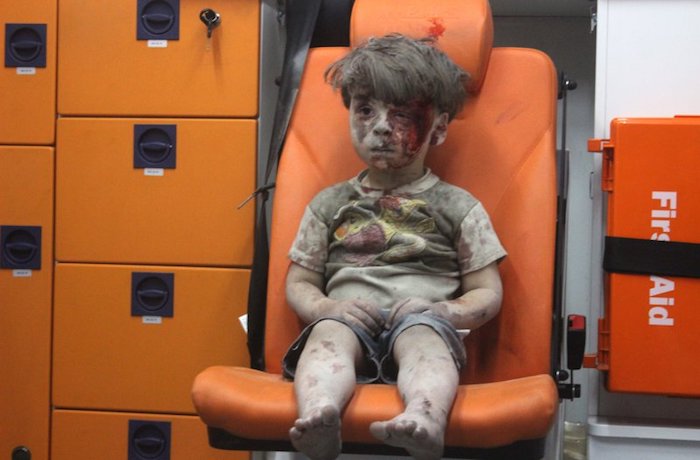 omran-daqneesh-ali-dead.jpg